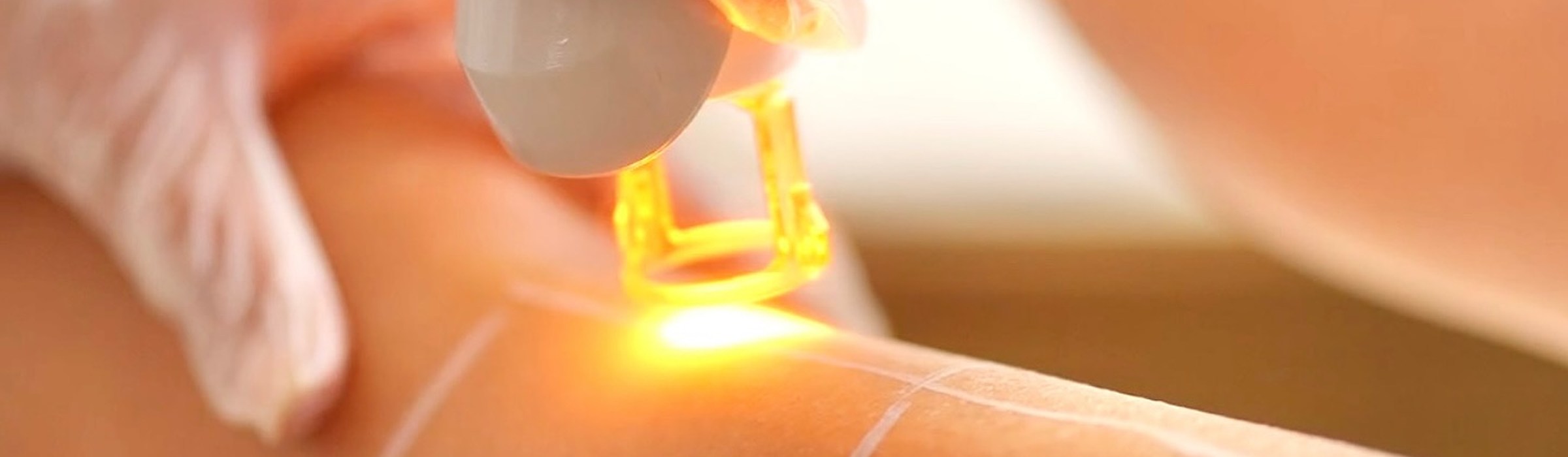 Maison du Laser - Centre d'épilation laser médical à Paris - Tarifs épilation laser
